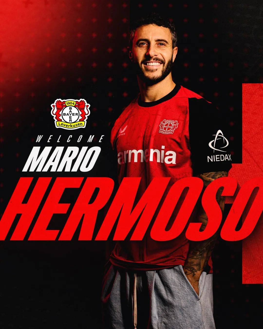 关于沃尔夫斯堡球员受伤，将缺席下场比赛的信息